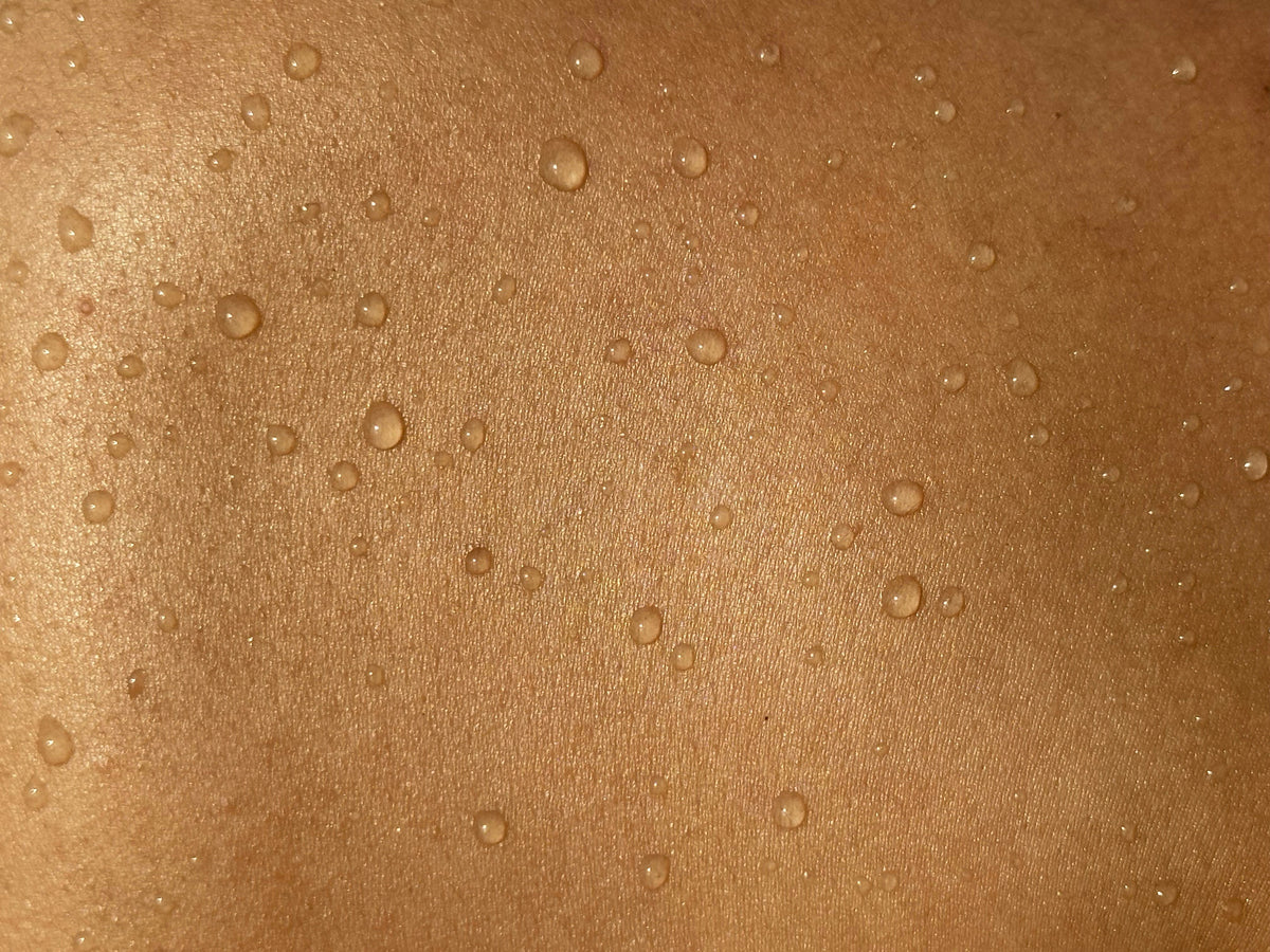 Dryness & Eczema